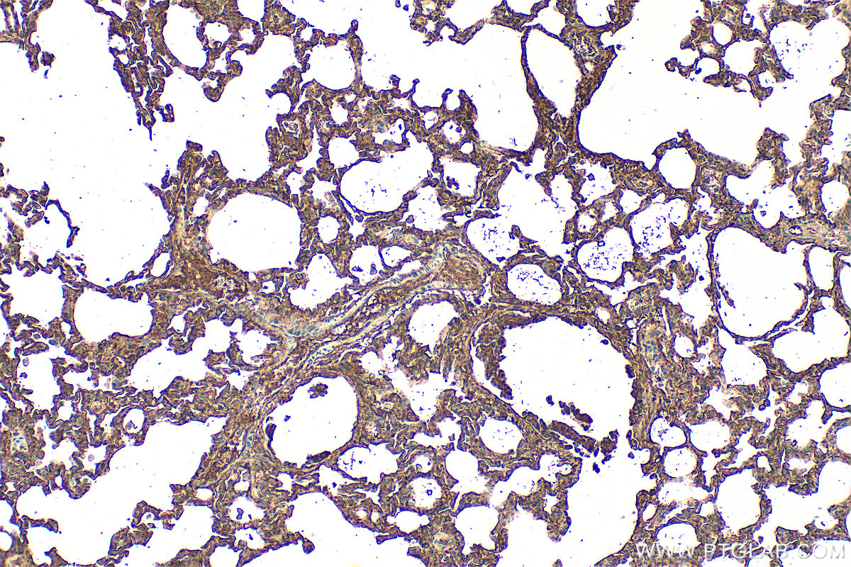 IHC staining of rat lung using 32053-1-AP