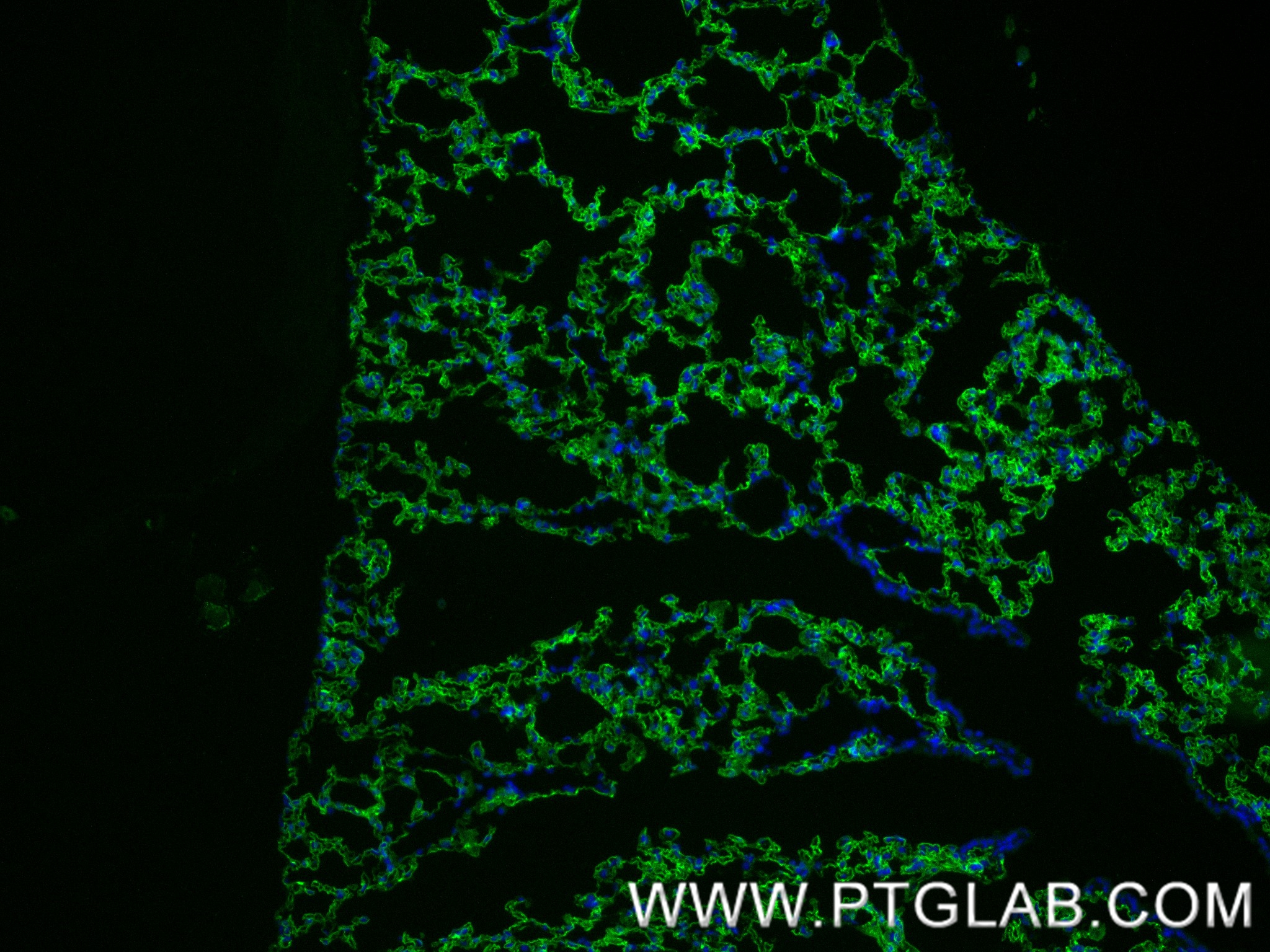 IF Staining of mouse lung using 83759-5-RR