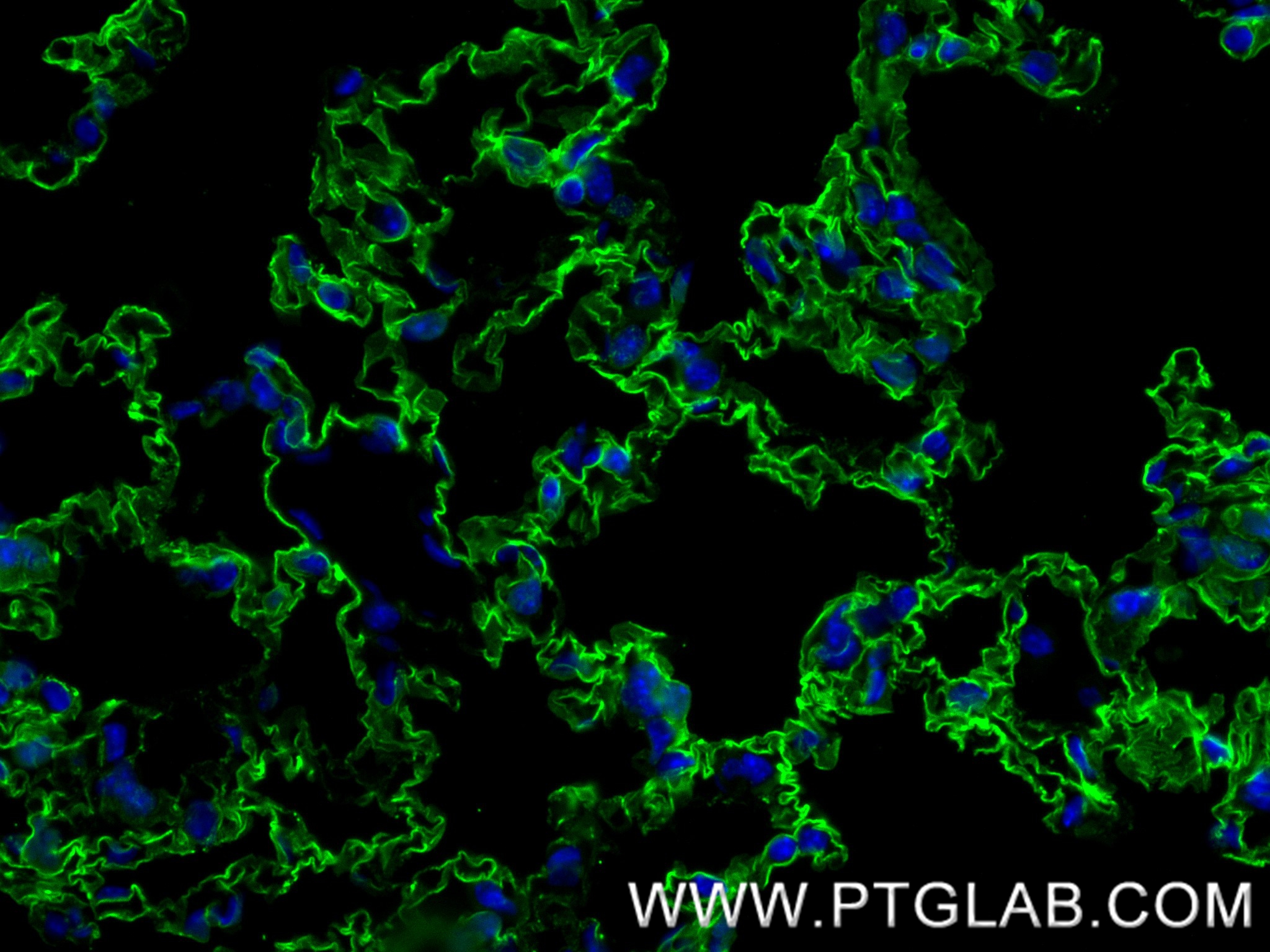 IF Staining of mouse lung using 83759-5-RR