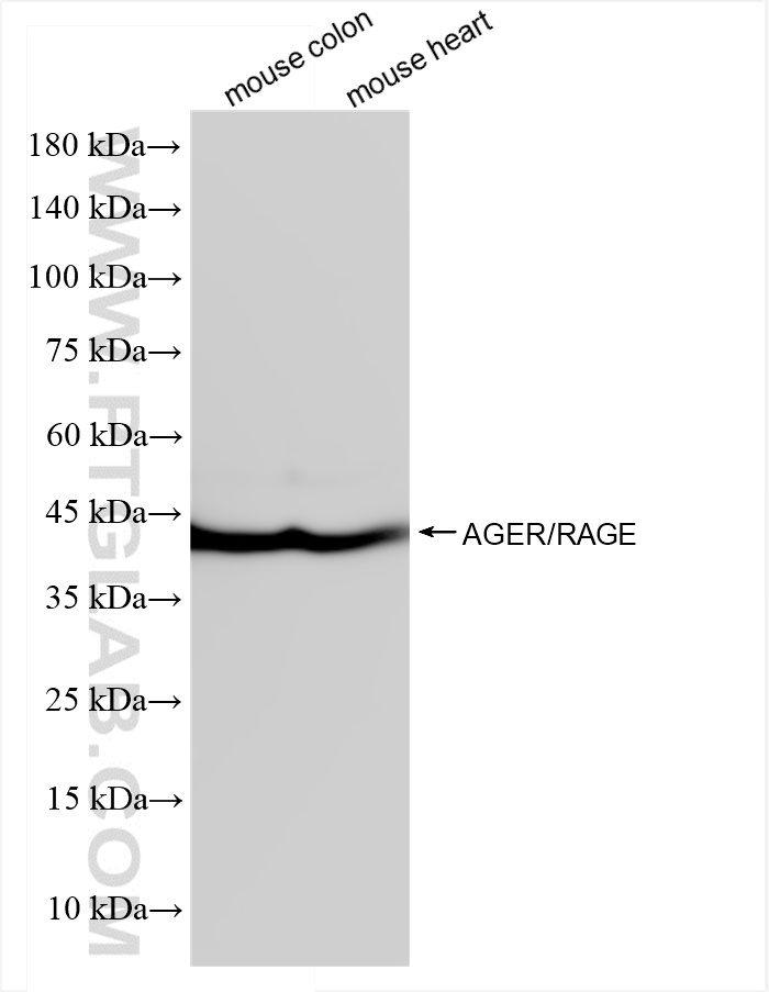 WB analysis using 83759-5-RR