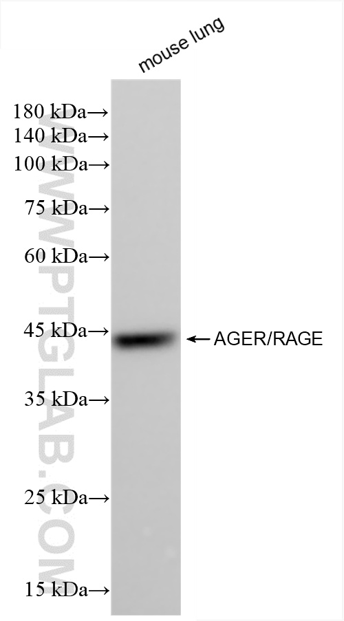 WB analysis of mouse lung using 85349-1-RR