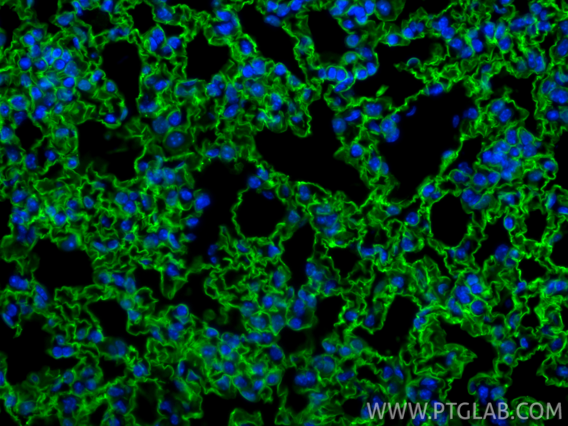 IF Staining of mouse lung using CL488-83759-5