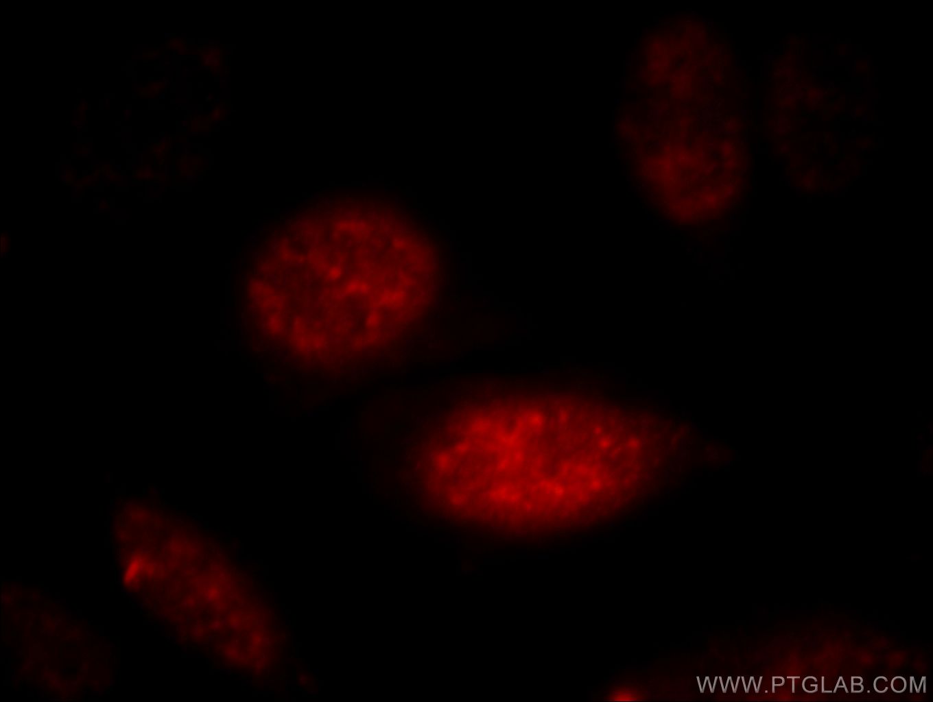 IF Staining of HepG2 using 11919-1-AP