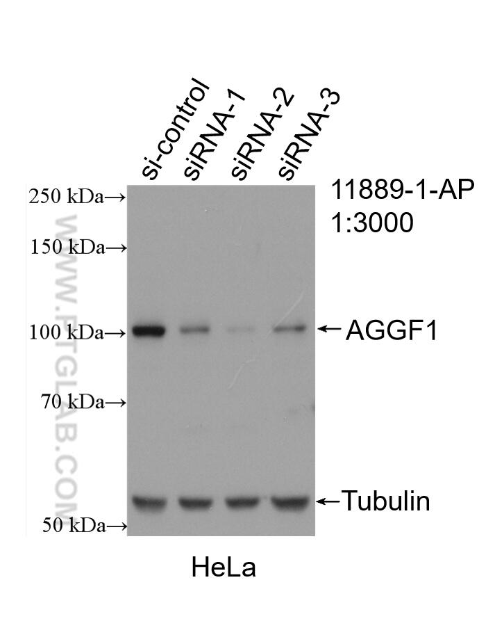 WB analysis of HeLa using 11889-1-AP