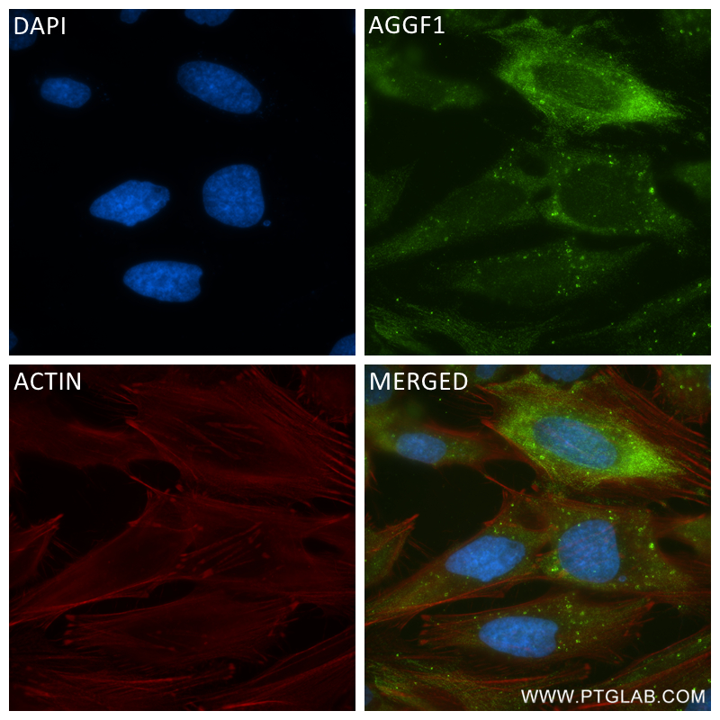 IF Staining of HeLa using 84715-4-RR