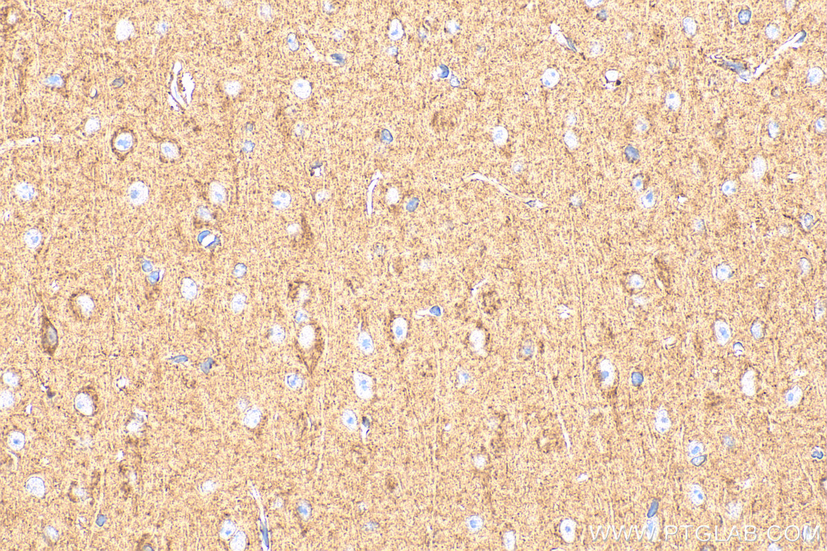 IHC staining of mouse brain using 33759-1-AP