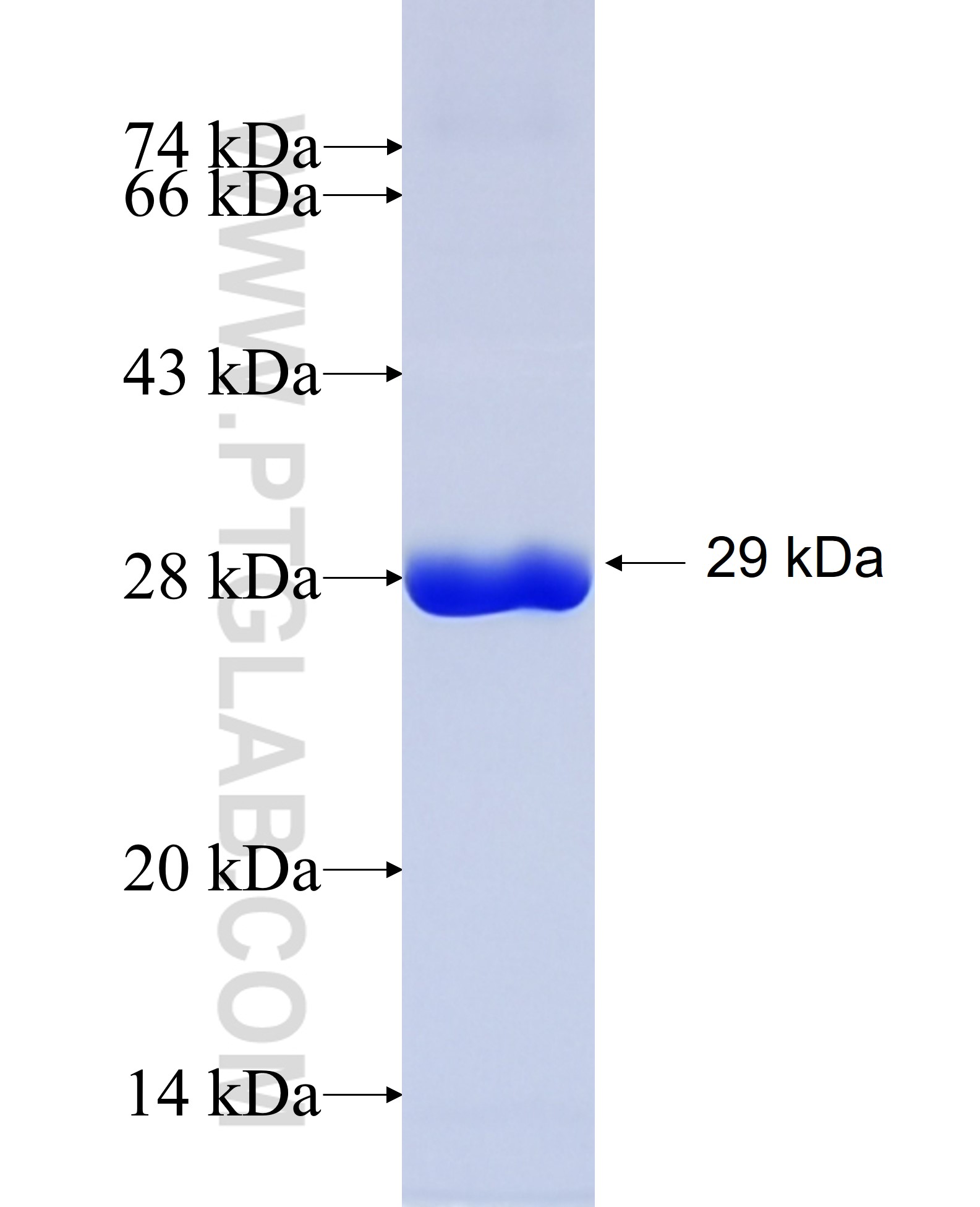 AGK fusion protein Ag34541 SDS-PAGE