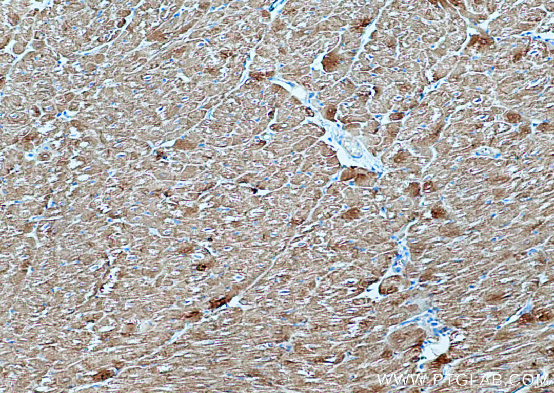 IHC staining of human heart using 16582-1-AP