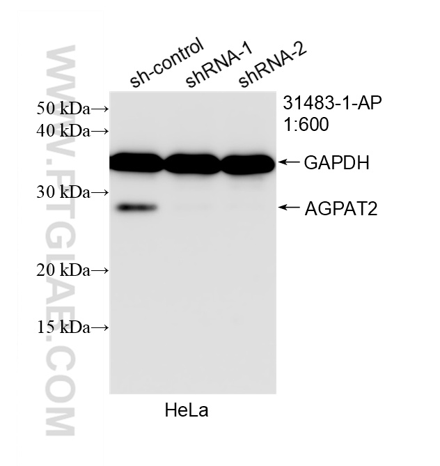 WB analysis of HeLa using 31483-1-AP