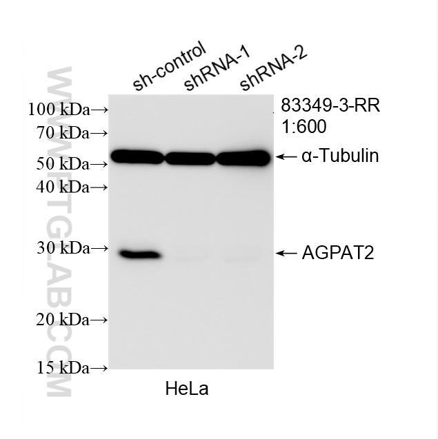 WB analysis of HeLa using 83349-3-RR (same clone as 83349-3-PBS)