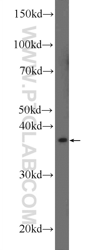 WB analysis of mouse testis using 25723-1-AP