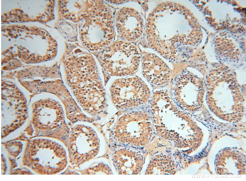 IHC staining of human testis using 16762-1-AP