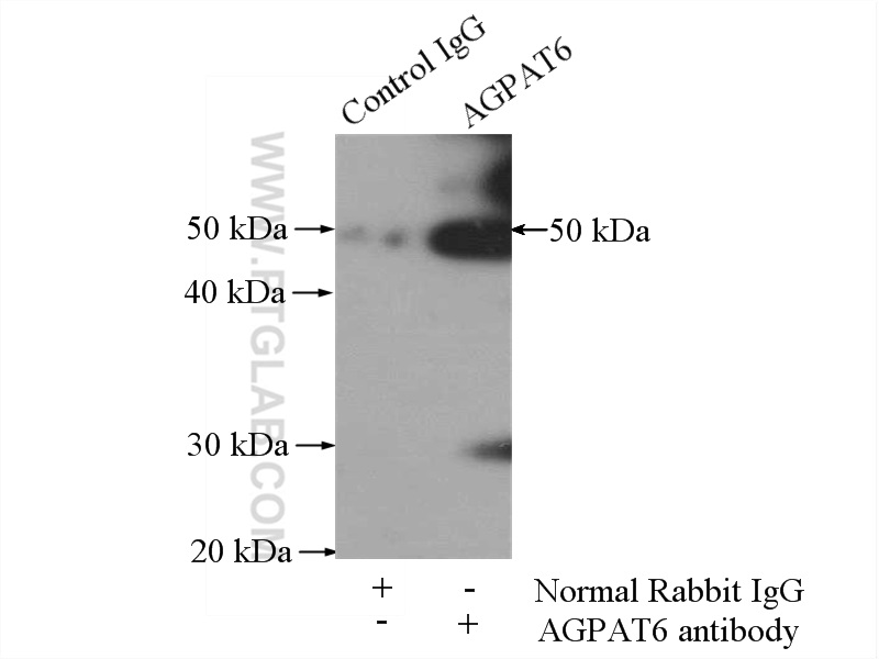 IP experiment of mouse brain using 16762-1-AP