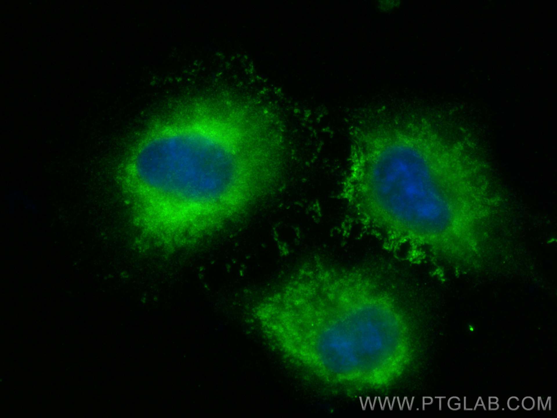 IF Staining of A549 using 12275-1-AP