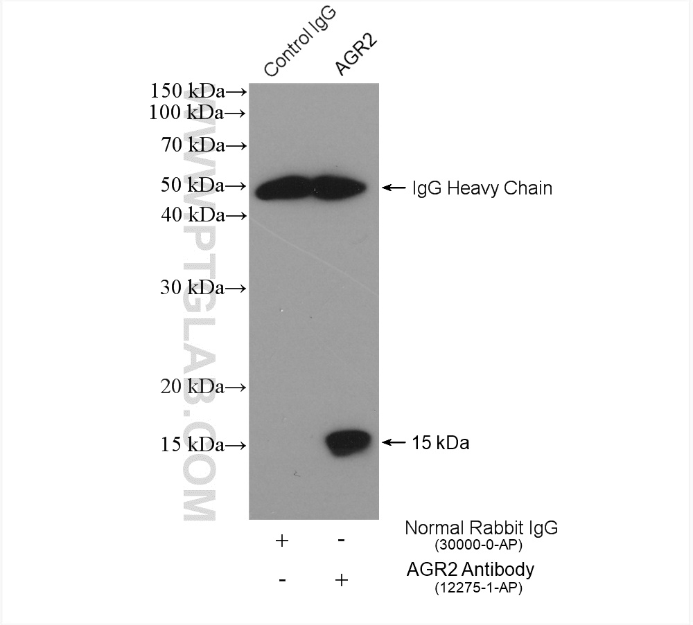 IP experiment of A549 using 12275-1-AP