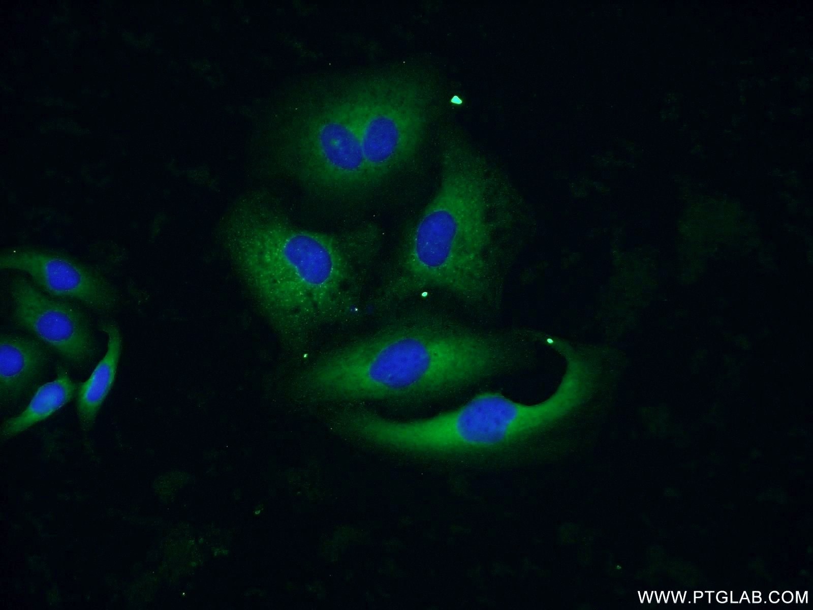 IF Staining of SKOV-3 using 11967-1-AP