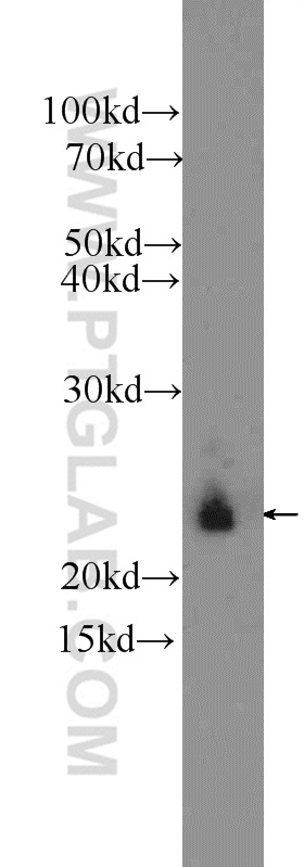 WB analysis of SKOV-3 using 11967-1-AP