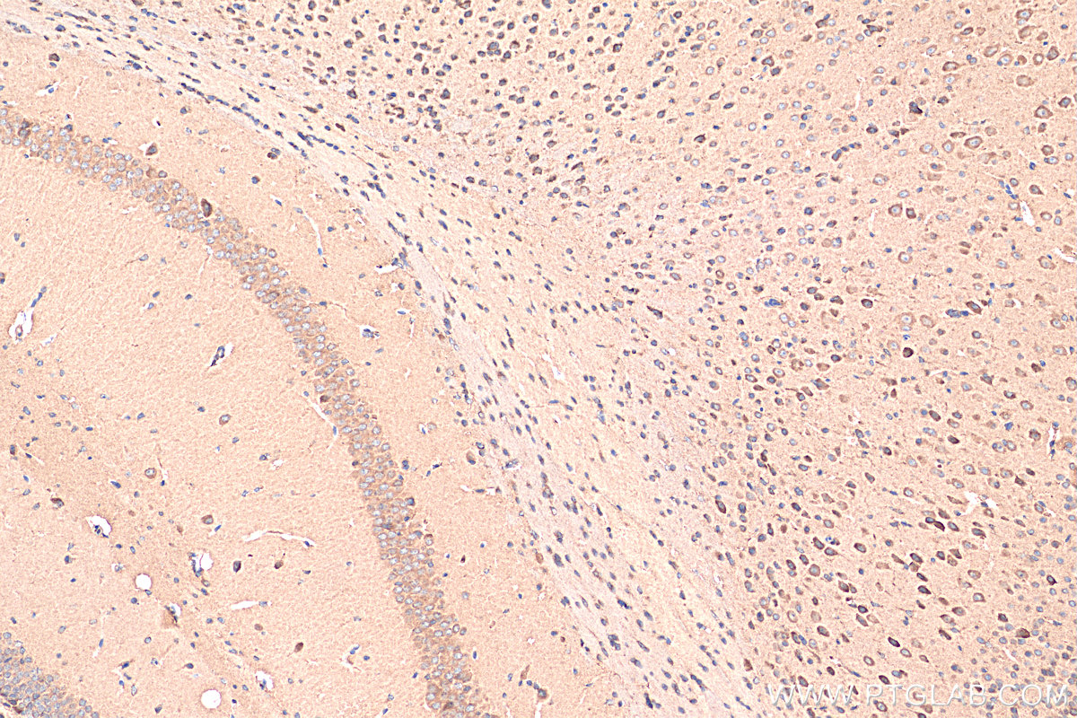 IHC staining of mouse brain using 21249-1-AP