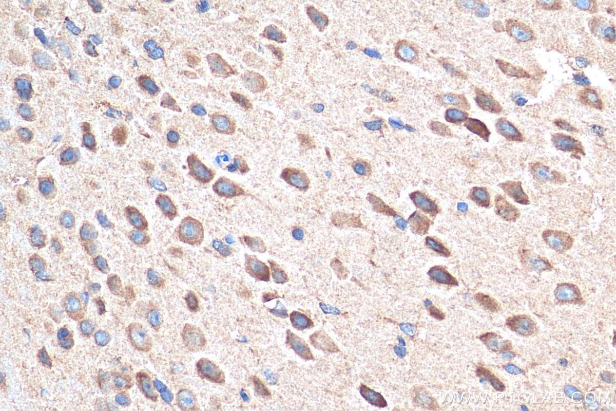 IHC staining of mouse brain using 21249-1-AP