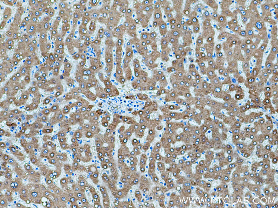 IHC staining of human liver using 11992-1-AP