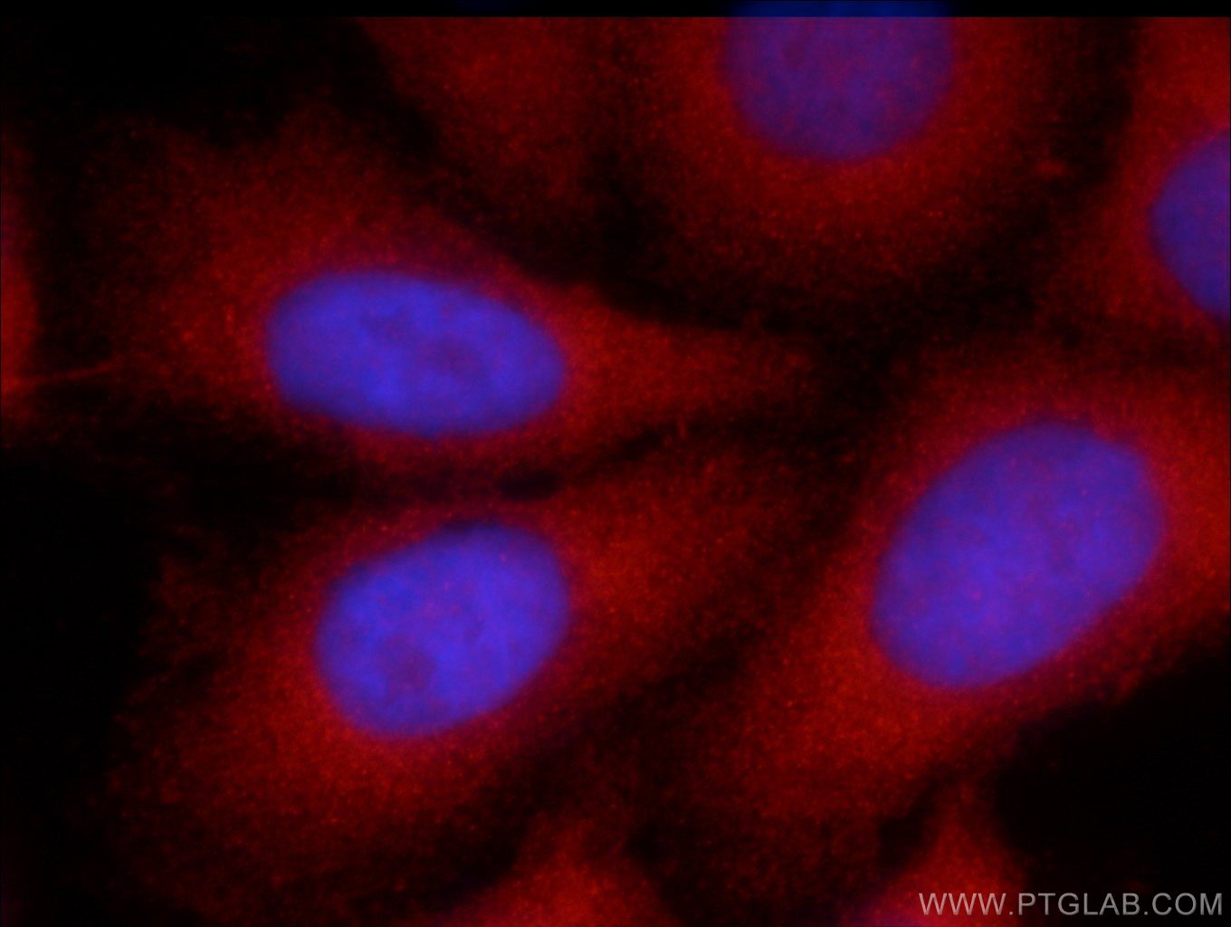 IF Staining of HepG2 using 23972-1-AP