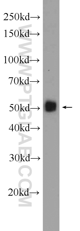 Angiotensinogen