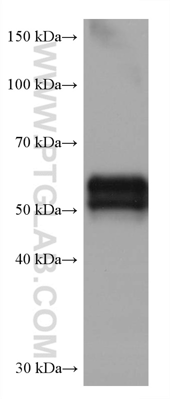 WB analysis of human placenta using 68020-1-Ig (same clone as 68020-1-PBS)