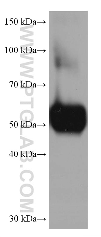 WB analysis of human plasma using 68020-1-Ig (same clone as 68020-1-PBS)