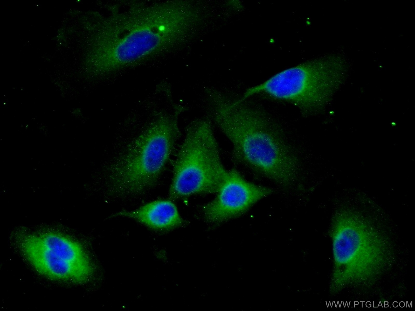 IF Staining of A549 using 14067-1-AP