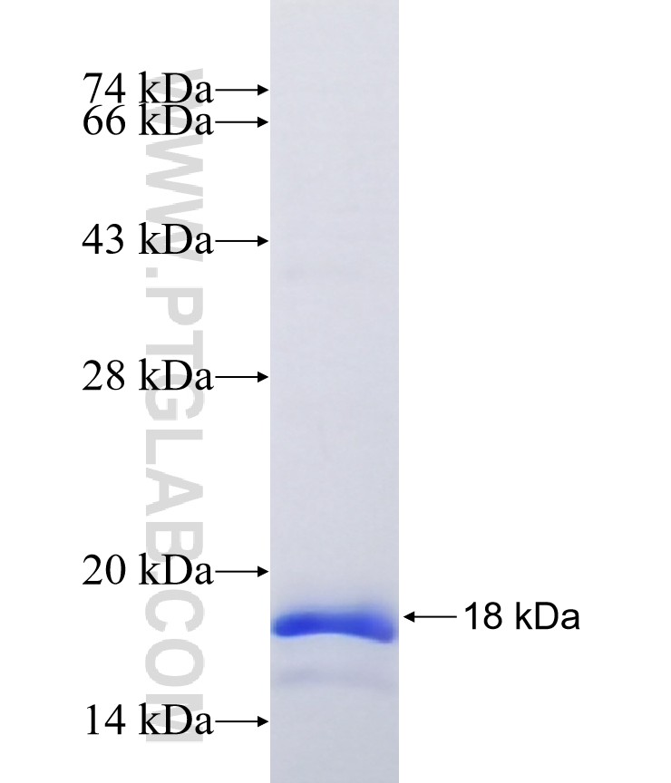 AGTR1 fusion protein Ag41562 SDS-PAGE AGTR1 fusion protein Ag41562 SDS-PAGE