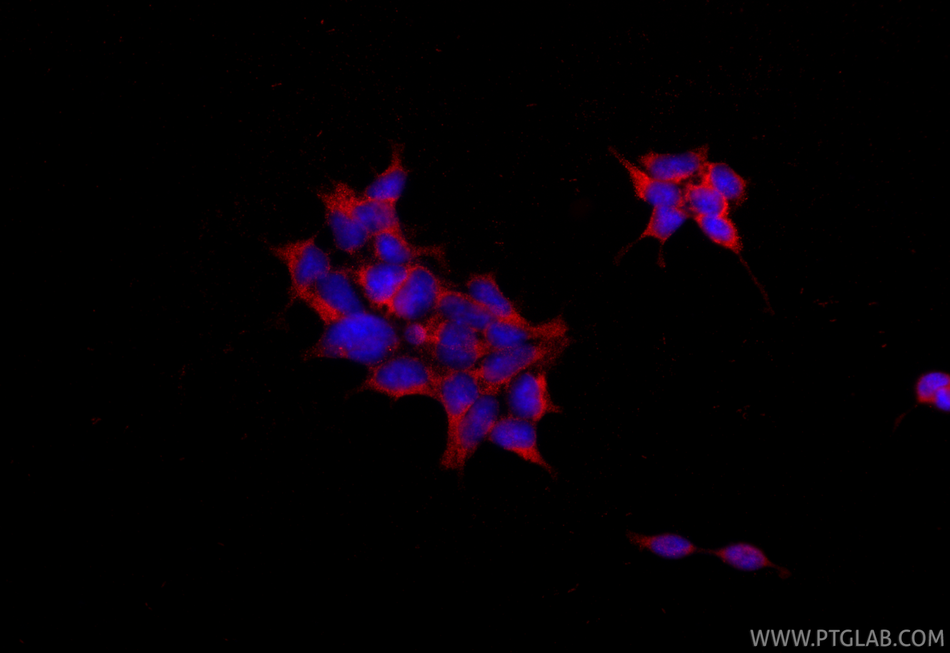 Immunofluorescent analysis of (-20°C Ethanol) fixed HEK-293 cells using AGTR2 antibody (<a class='green' href='/productredirect?CatalogNo=30963-1-AP' target='_blank'>30963-1-AP</a>) at dilution of 1:200 and CoraLite®594-Conjugated Goat Anti-Rabbit IgG(H+L) (<a class='green' href='/productredirect?CatalogNo=SA00013-4' target='_blank'>SA00013-4</a>). This data was developed using the same antibody clone with 30963-1-PBS in a different storage buffer formulation. IF Staining of HEK-293 using 30963-1-AP (same clone as 30963-1-PBS)