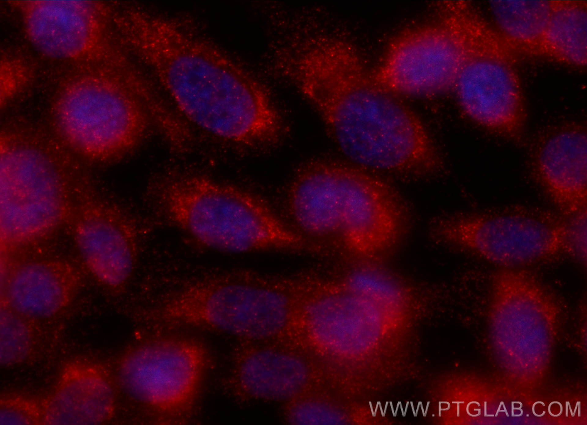 IF Staining of PC-3 using 11559-1-AP