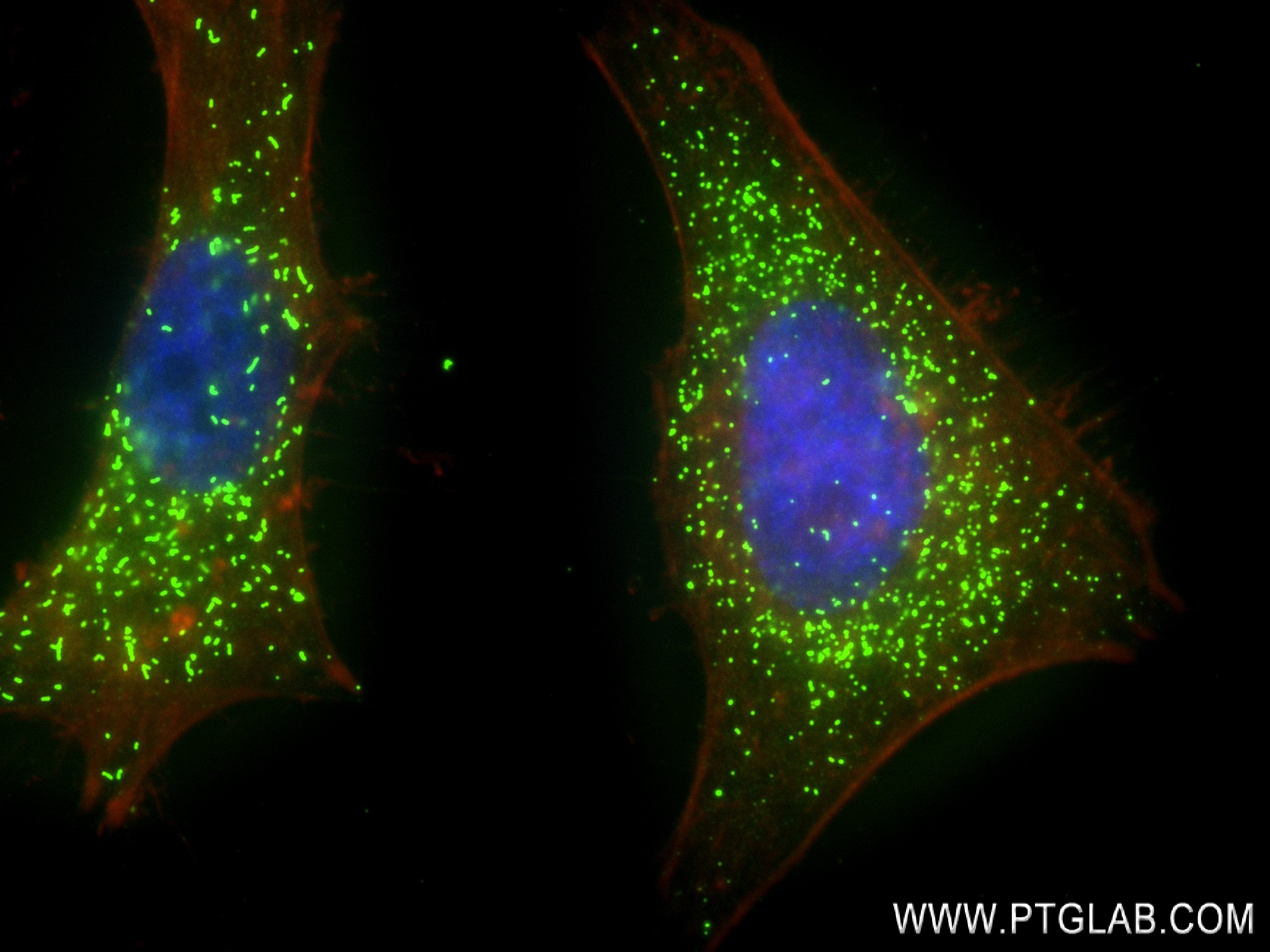 IF Staining of HeLa using 83385-6-RR (same clone as 83385-6-PBS)