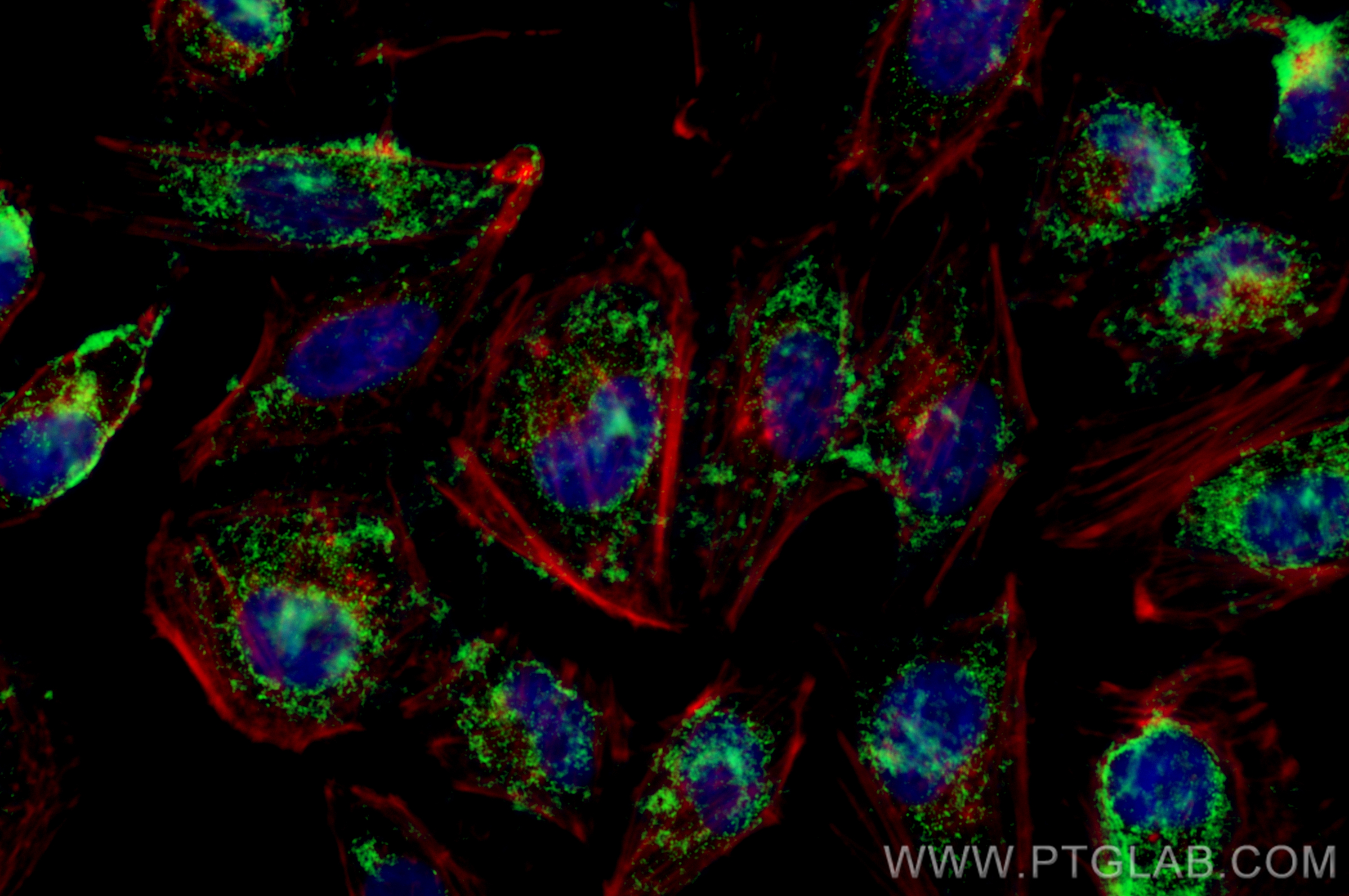 IF Staining of HeLa using CL488-83385-6