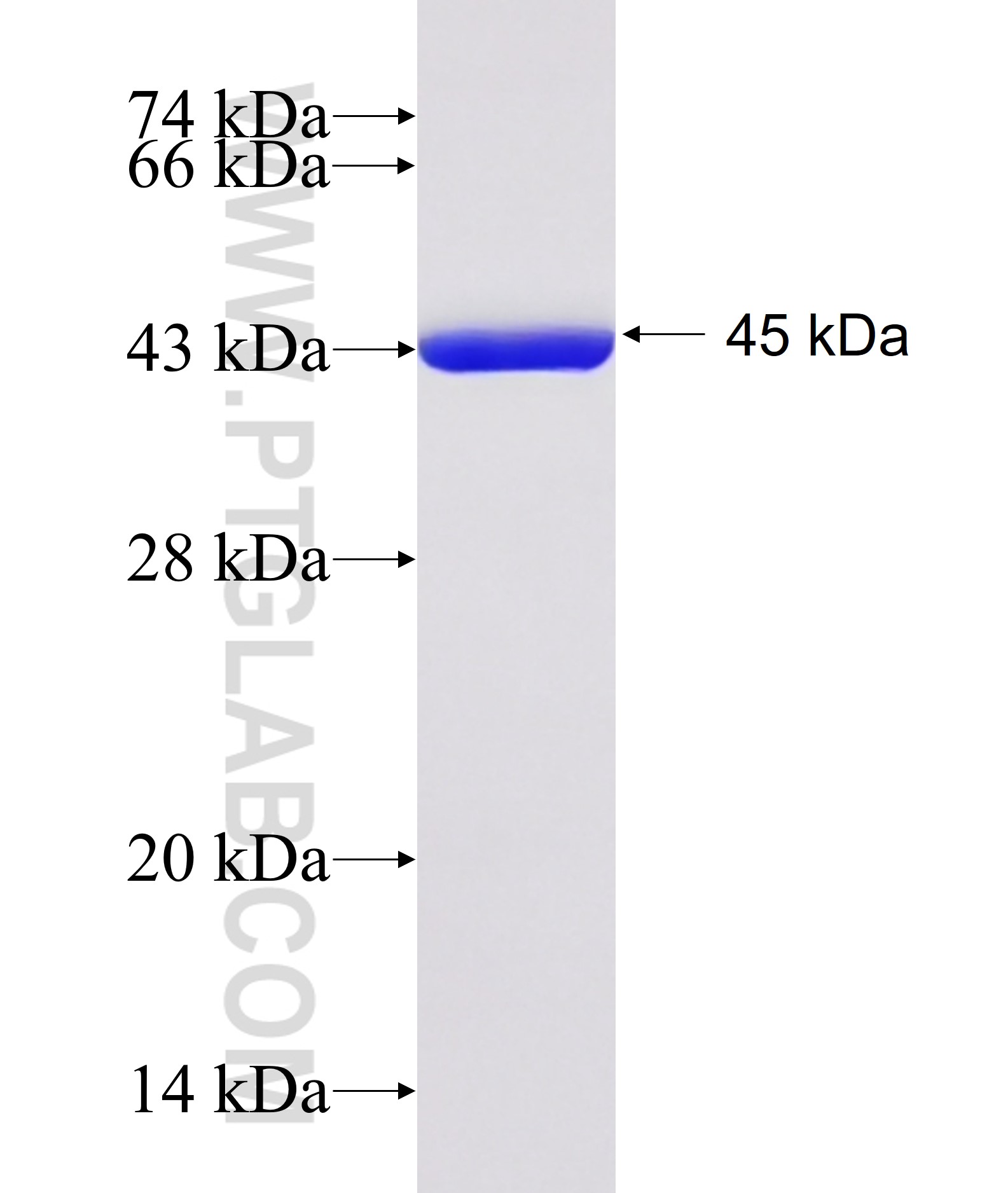 AGXT fusion protein Ag19188 SDS-PAGE