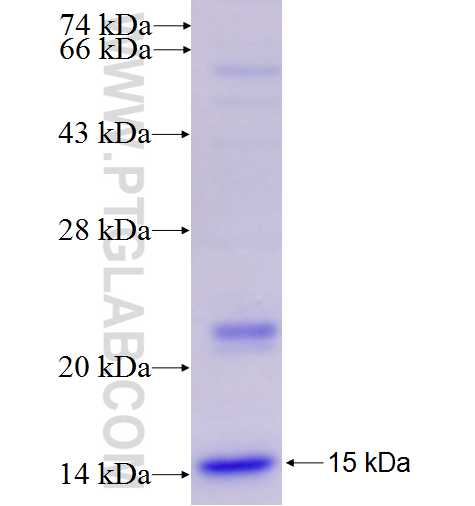 AGXT2 fusion protein Ag26888 SDS-PAGE