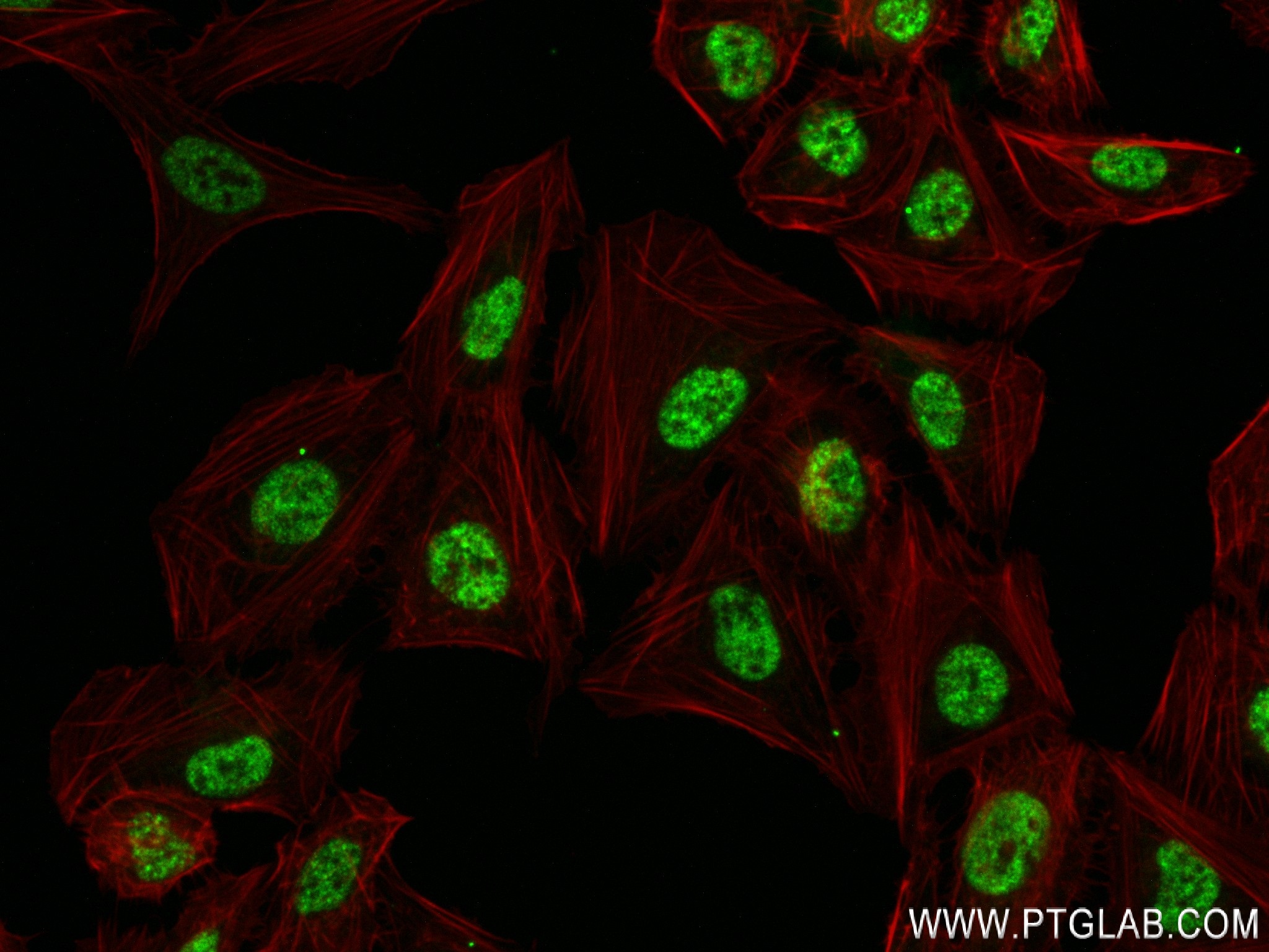 IF Staining of U2OS using 83984-5-RR (same clone as 83984-5-PBS)