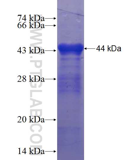 AGXT2L1 fusion protein Ag10848 SDS-PAGE AGXT2L1 fusion protein Ag10848 SDS-PAGE