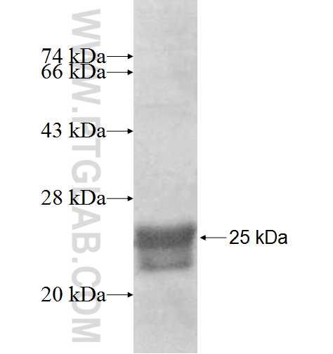 AGXT2L2 fusion protein Ag8374 SDS-PAGE AGXT2L2 fusion protein Ag8374 SDS-PAGE