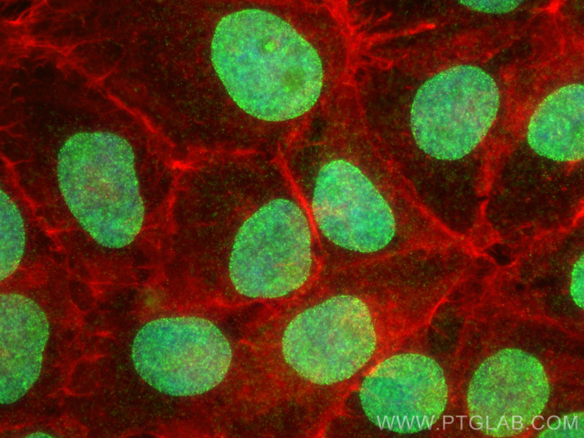 IF Staining of A431 using 30923-1-AP (same clone as 30923-1-PBS) IF Staining of A431 using 30923-1-AP (same clone as 30923-1-PBS)