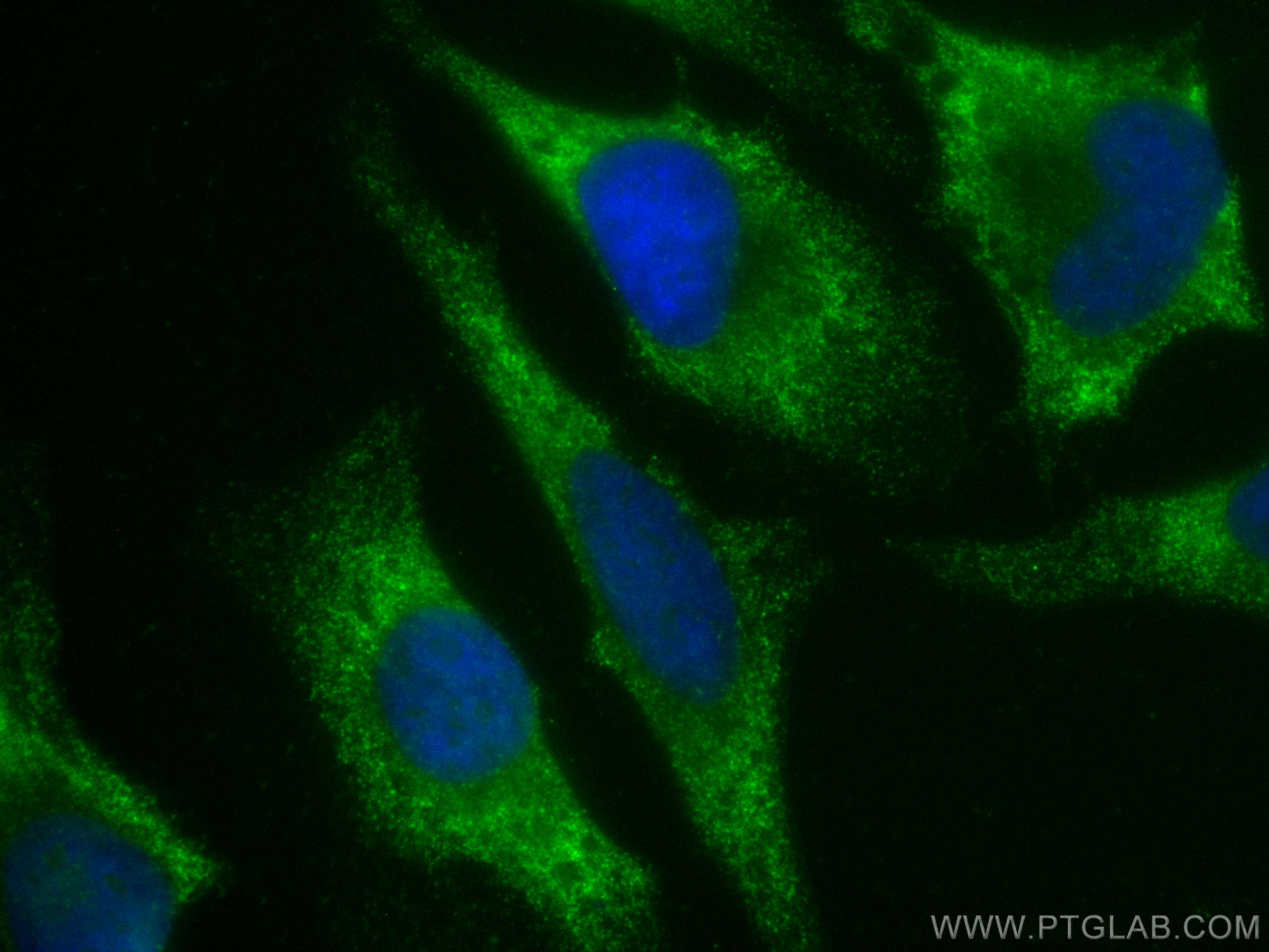 IF Staining of HeLa using 66019-1-Ig (same clone as 66019-1-PBS)