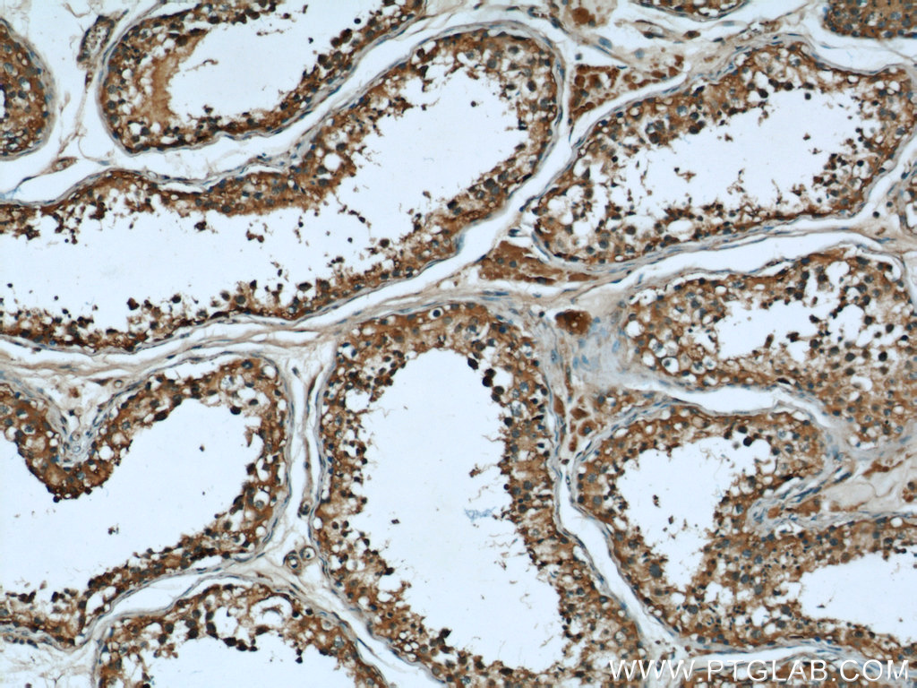 IHC staining of human testis using 66019-1-Ig (same clone as 66019-1-PBS)