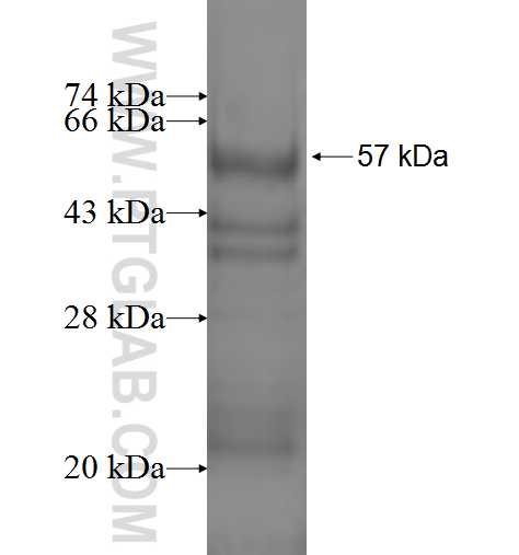 AHCY fusion protein Ag1208 SDS-PAGE