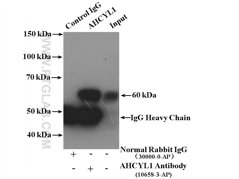 IP experiment of HeLa using 10658-3-AP