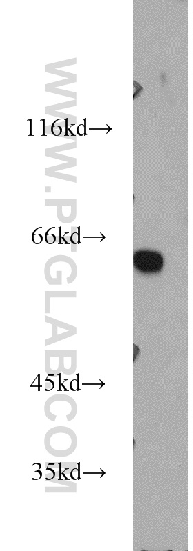 WB analysis of Jurkat using 10658-3-AP