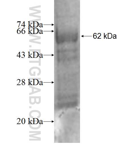 AHCYL1 fusion protein Ag1017 SDS-PAGE