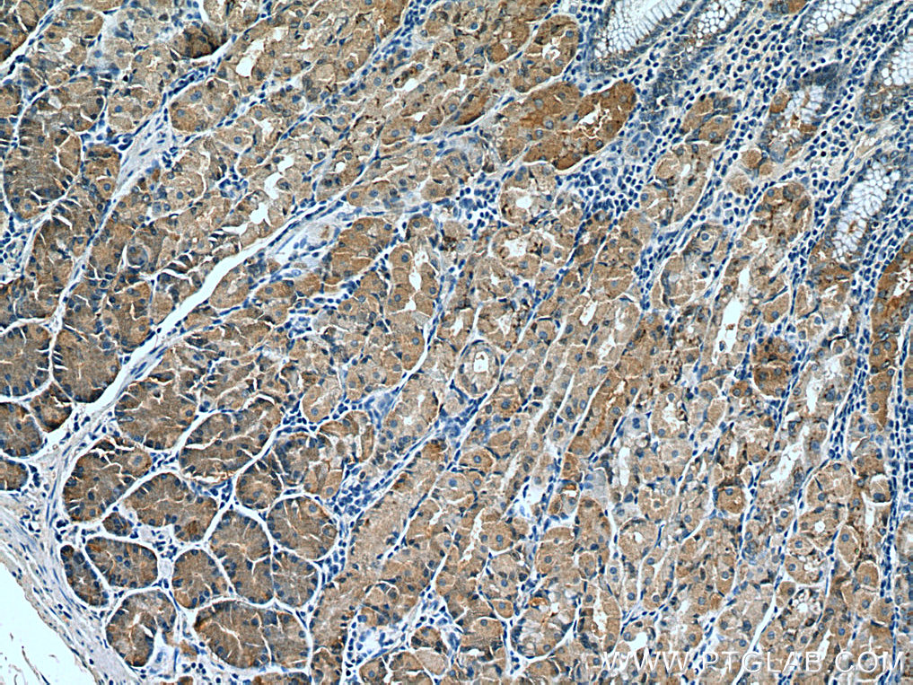 IHC staining of human stomach using 67484-1-Ig