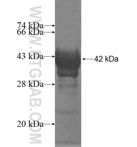 AHNAK fusion protein Ag9986 SDS-PAGE