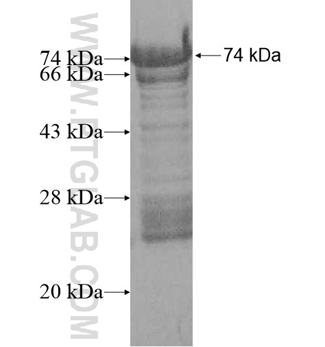 AHNAK2 fusion protein Ag11779 SDS-PAGE