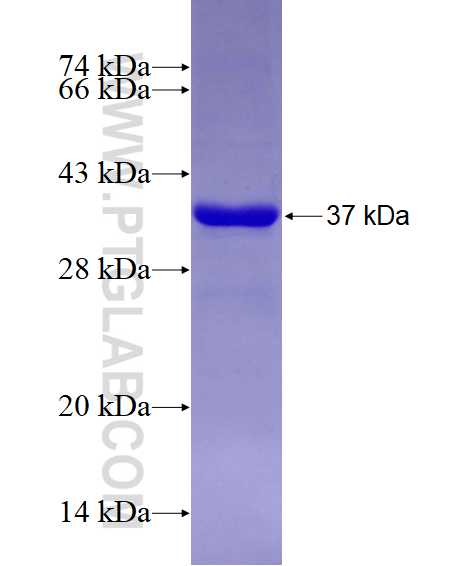 AHR fusion protein Ag28935 SDS-PAGE